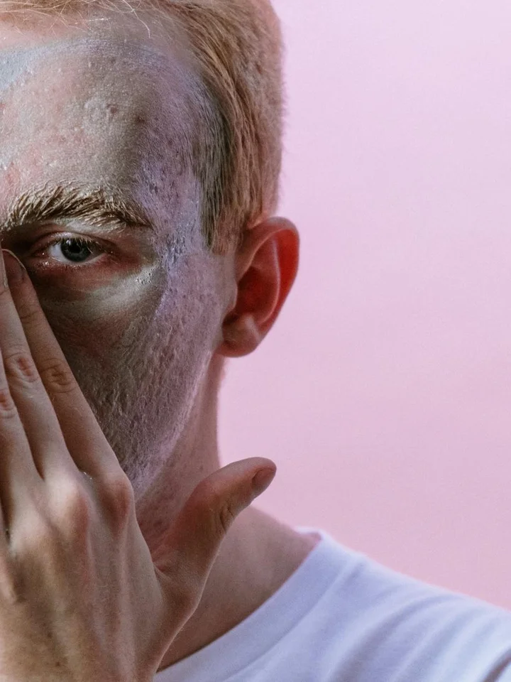 Adapalene Purging Timeline: Your Week-by-Week Guide to Clear Skin