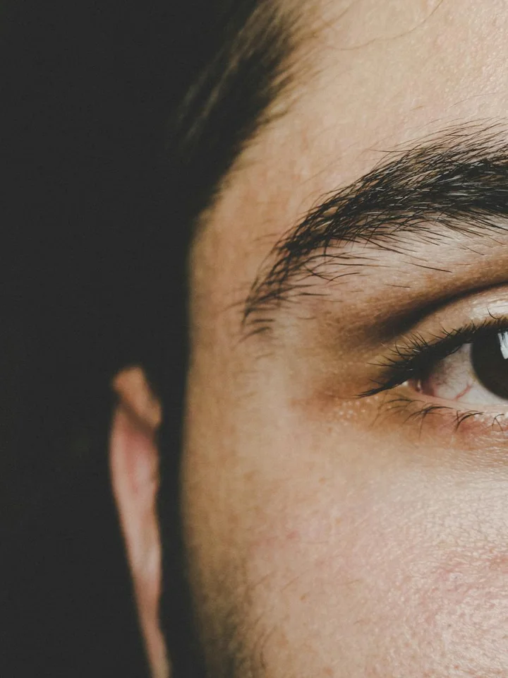 Close-up of a person's face focusing on the cheek and eyebrow, showing skin texture.