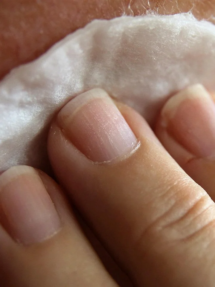 Combining Salicylic Acid and Azelaic Acid: A Simple Routine for Acne and Dark Spots