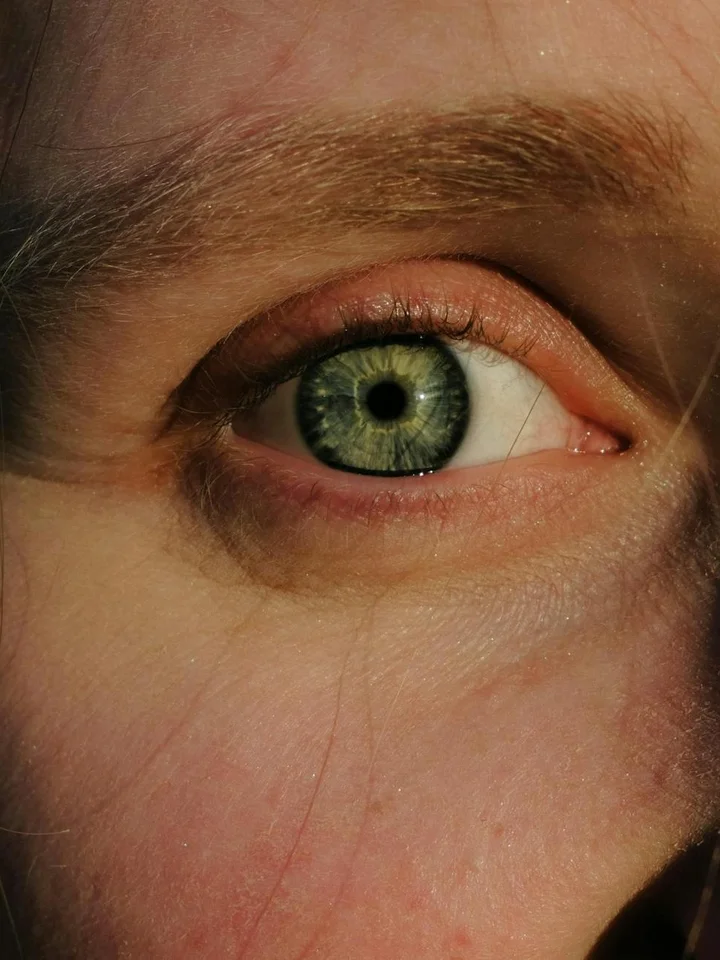 Close-up of a green eye with surrounding skin