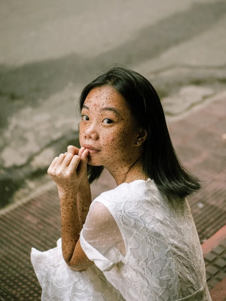 Woman with freckles wearing a white lace top outdoors, looking at the camera