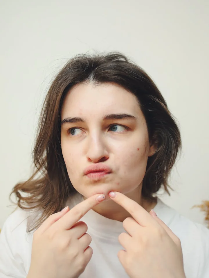 Close-up of a young woman with light acne looking to the side while touching her chin with her fingers.