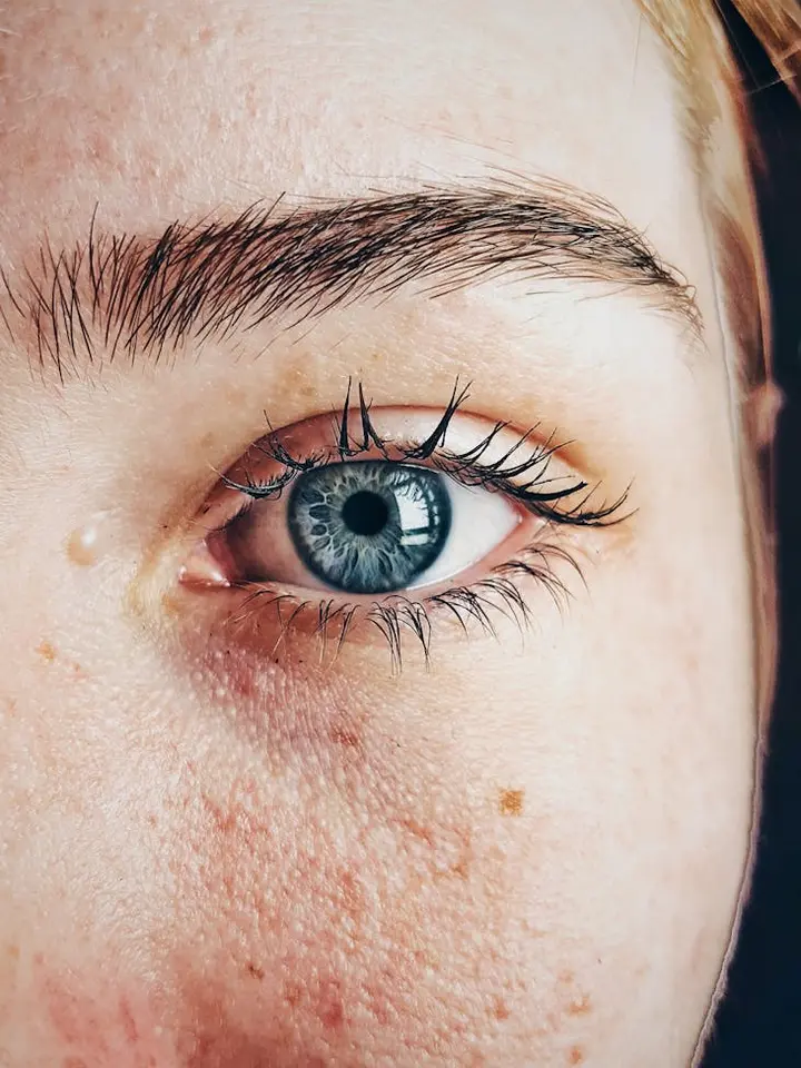 Close-up of a blue eye with surrounding fair skin showing light freckles and minor blemishes, highlighting skin texture.