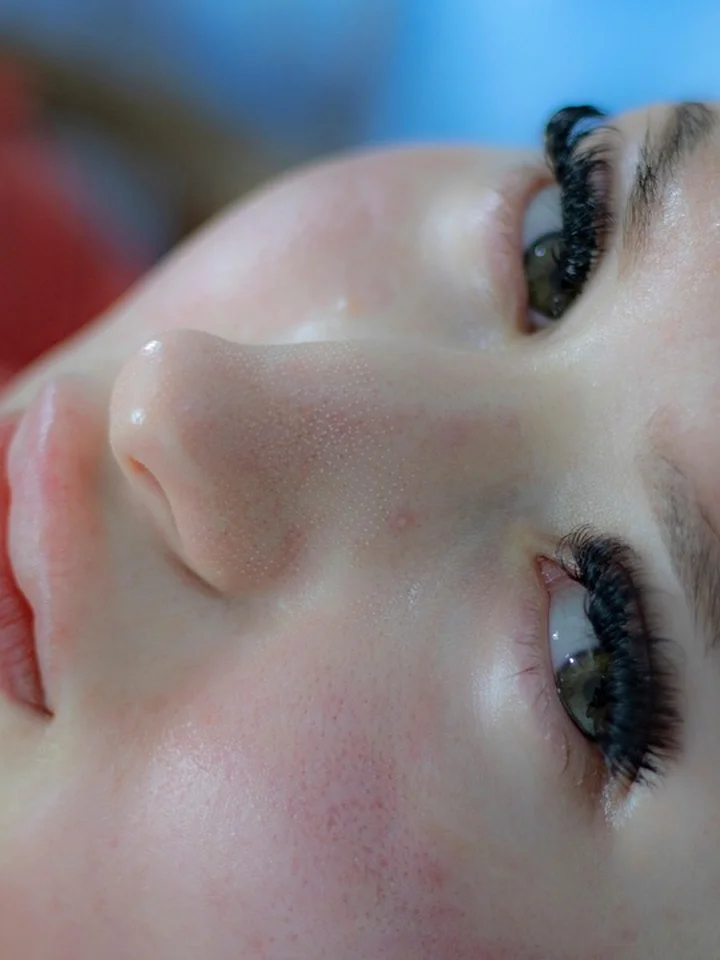 Close-up of a woman's face showing smooth skin and makeup, illustrating skin care context for Mandelic acid combinations.