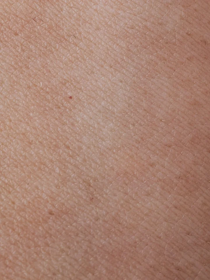 Close-up of skin texture with visible pores and fine lines, illustrating considerations for choosing a retinoid.