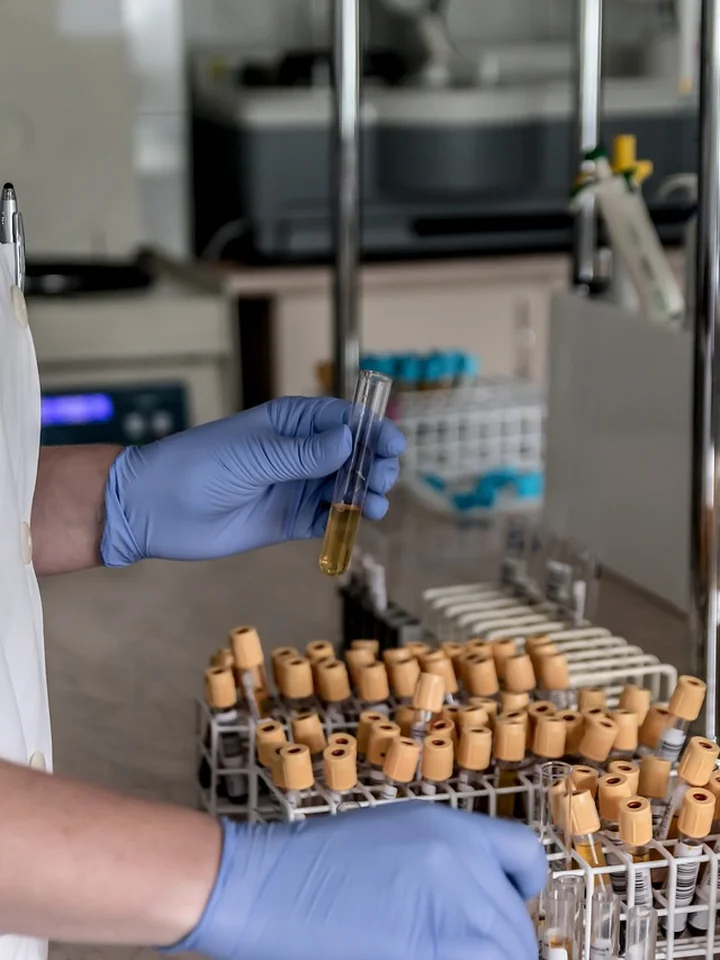 Hands in blue gloves holding a small vial above a rack of amber vials in a laboratory, illustrating skincare research