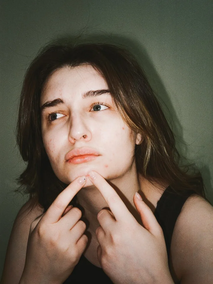 Portrait of a person with acne looking thoughtful, touching their chin, symbolizing skincare safety concerns.