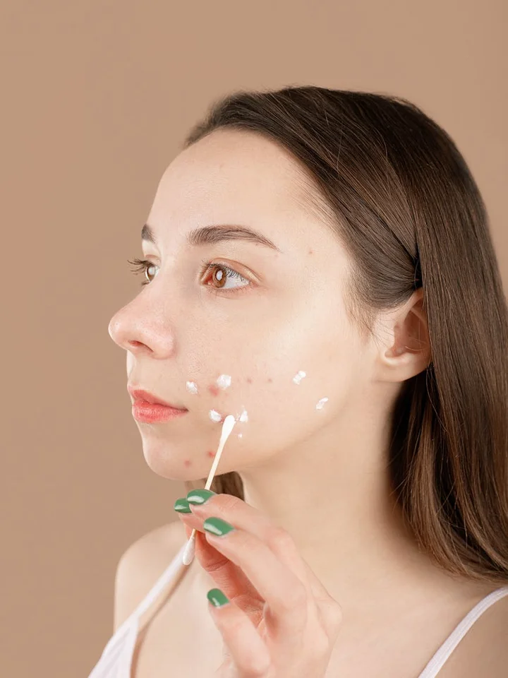 Portrait of a woman applying topical acne gel to her cheek with a cotton swab