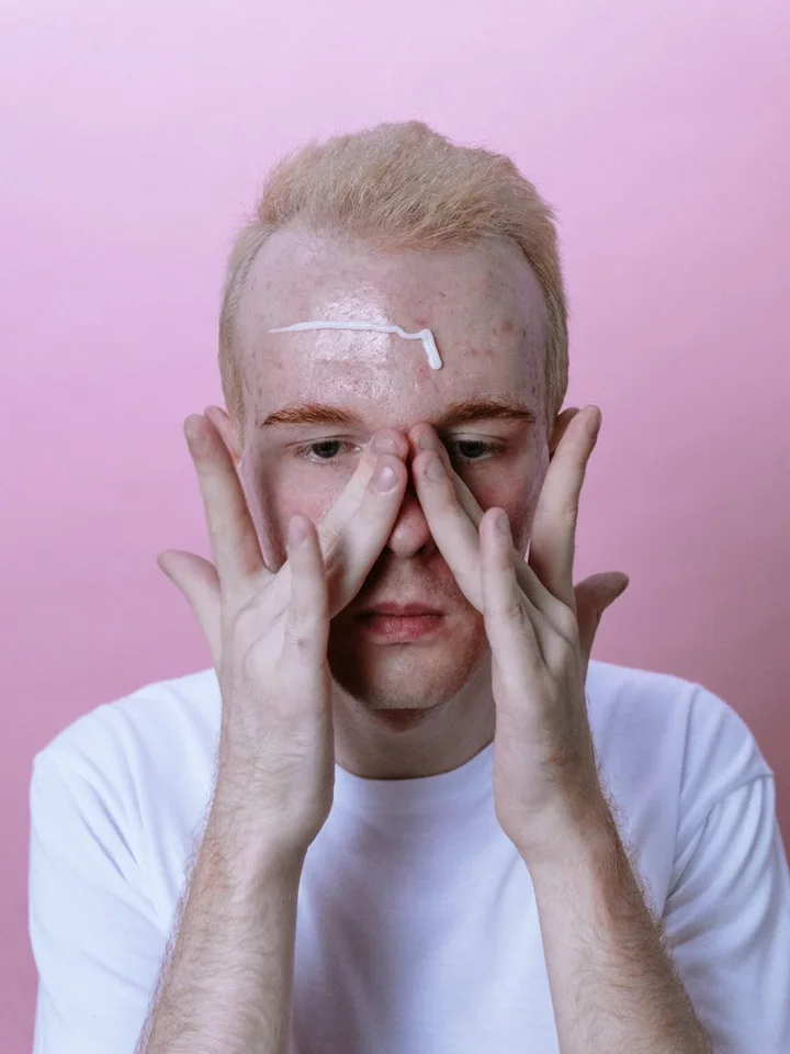 Person with acne on the forehead applying a skincare product against a pink backdrop.