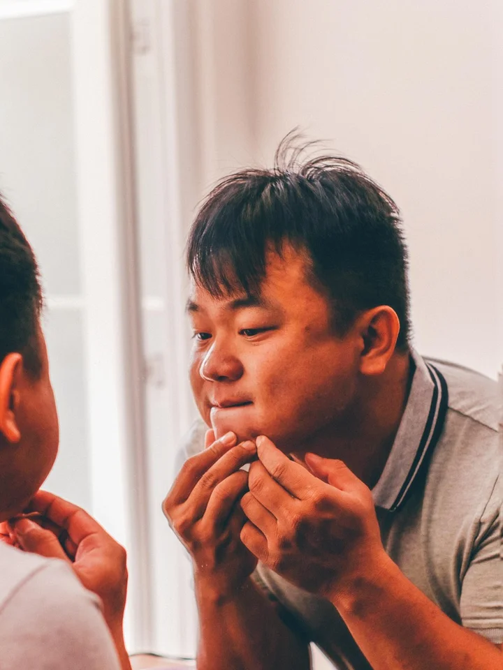 Adapalene: Your Practical Guide to Clearing Acne, Smoothing KP, and Healing Skin