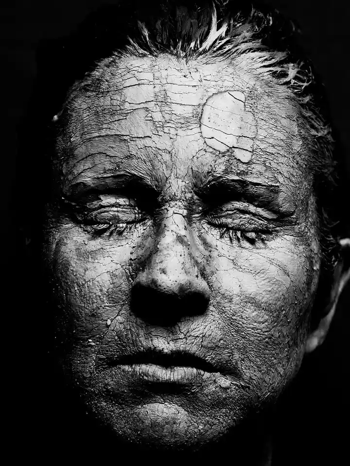 Alpha Arbutin Side Effects: What to Know for Safe, Brighter Skin