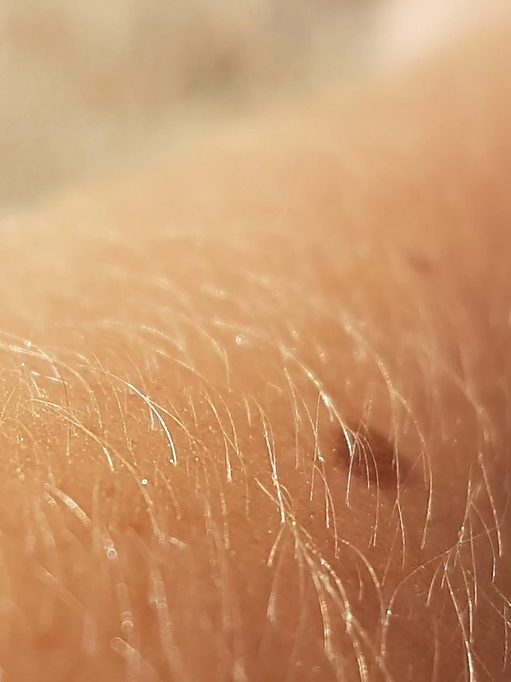 Niacinamide for Your Skin Barrier: The Expert Guide to Lasting Hydration and Strength