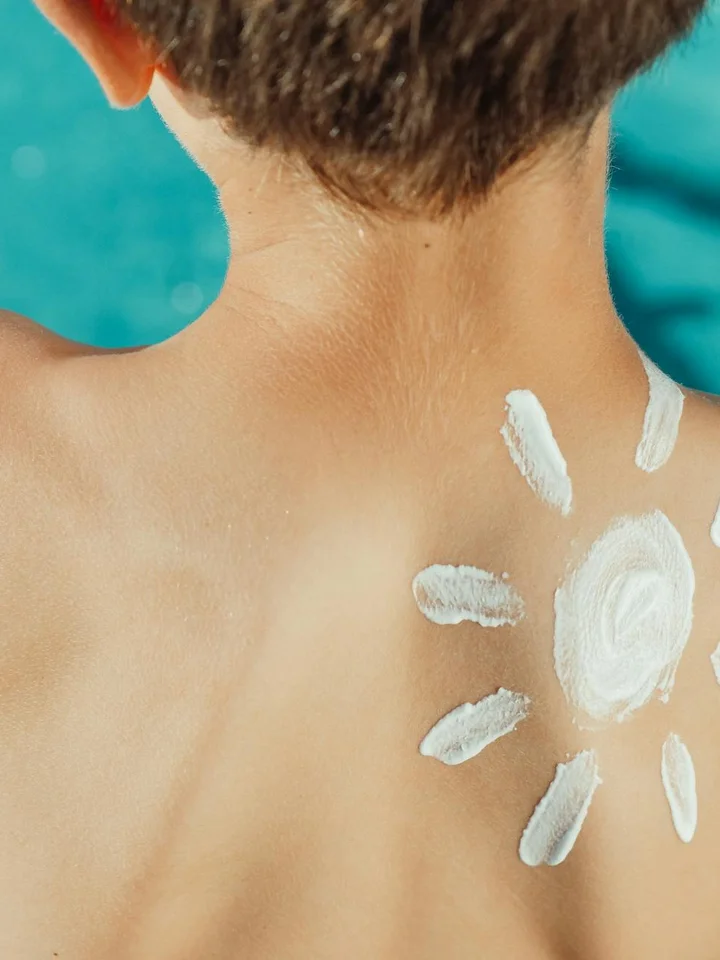 Back of a person's neck and shoulder with sunscreen cream applied in several white strokes, illustrating sun protection during skincare.