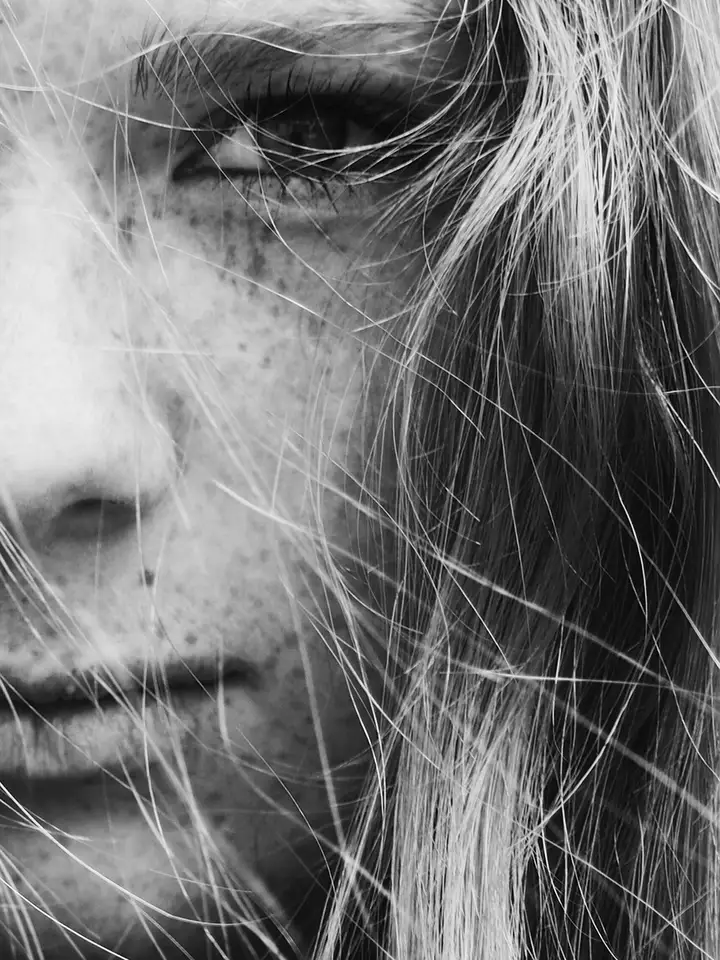 Close-up black-and-white portrait of a person with freckles and strands of hair across the face.