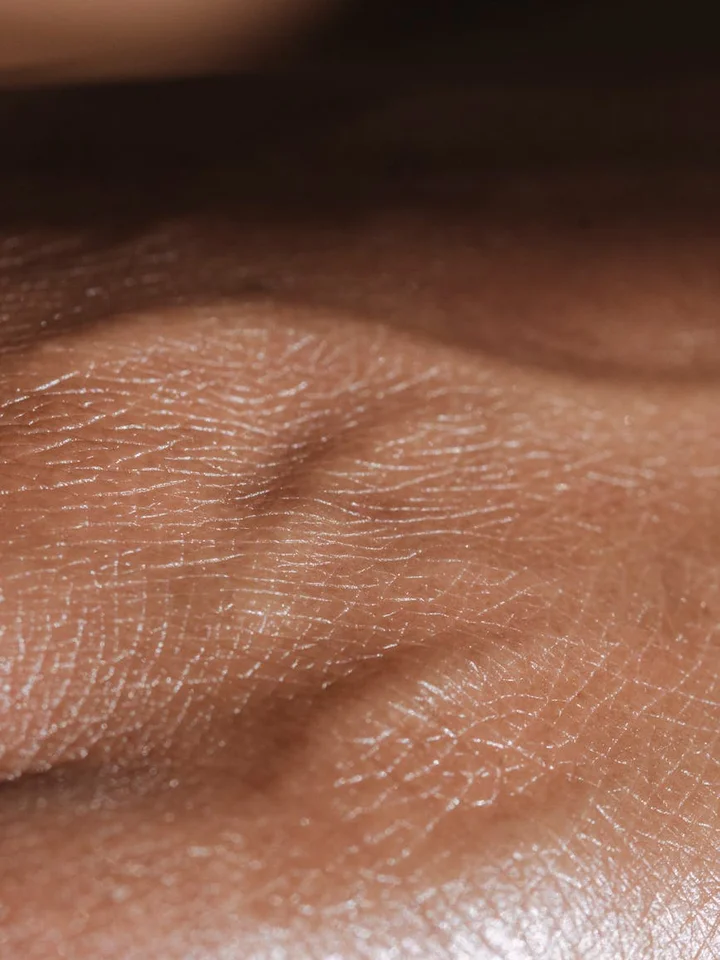 Close-up of facial skin showing visible pores and fine texture.