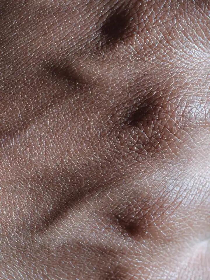 Close-up of textured facial skin with fine lines and visible pores.