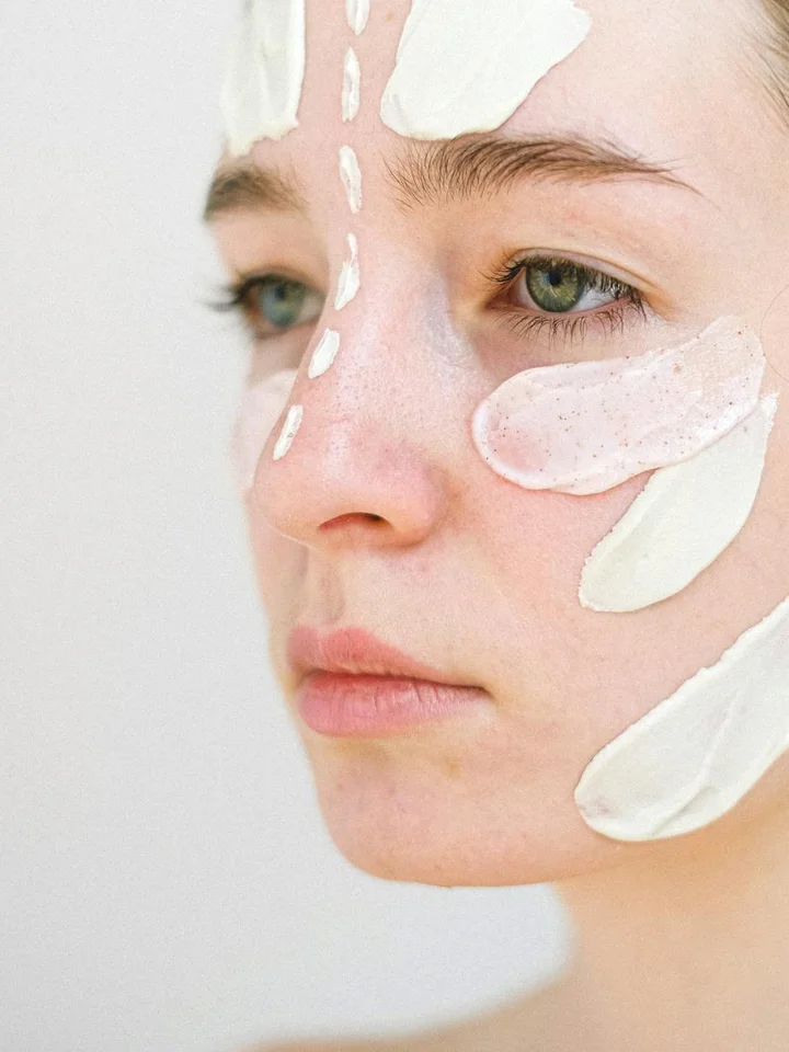 Close-up of a woman's face with white cream patches applied to cheeks and forehead.
