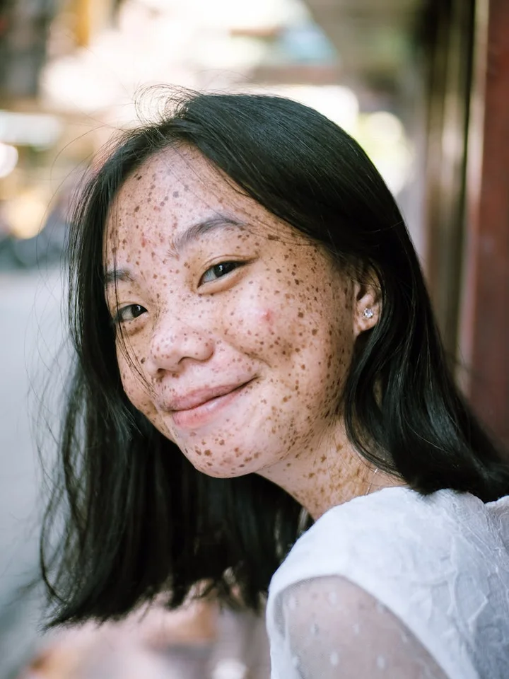 Close-up portrait of a smiling woman with freckles across her cheeks and nose.